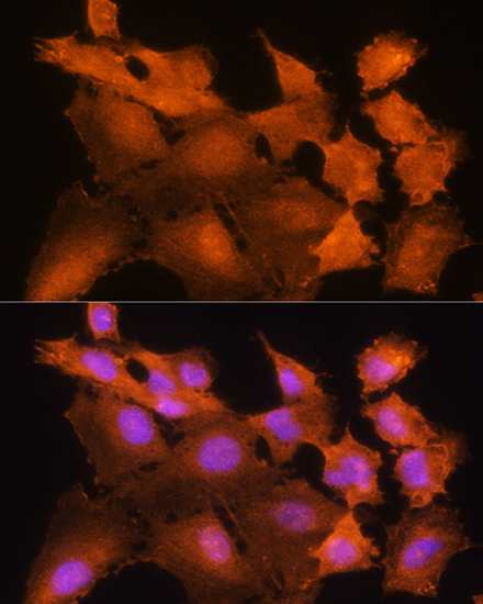 Anti-ADK Antibody (CAB15023)