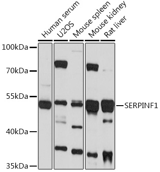 Anti-SERPINF1 Antibody (CAB16945)