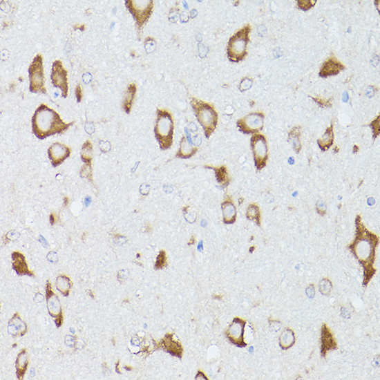 Anti-RPS18 Antibody (CAB11687)