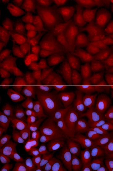 Anti-SNCG Antibody (CAB2524)