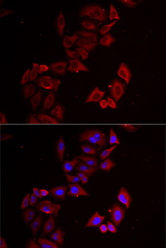 Anti-LIMS1 Antibody (CAB6384)