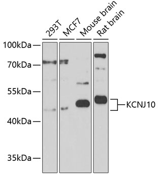 Anti-KCNJ10 Polyclonal Antibody (CAB9826)