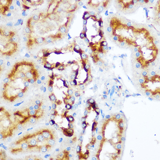 Anti-ACP5 Antibody (CAB2528)