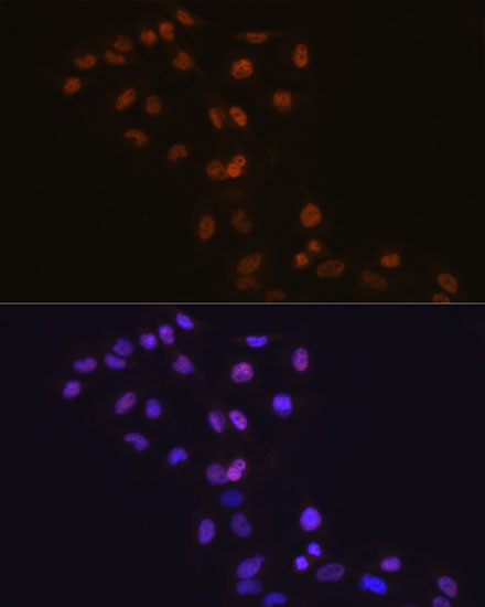 Anti-Dnmt1 Antibody [KO Validated] (CAB19679)