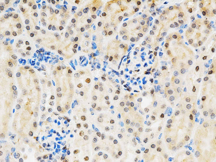 Anti-LGALS3 Antibody (CAB1464)