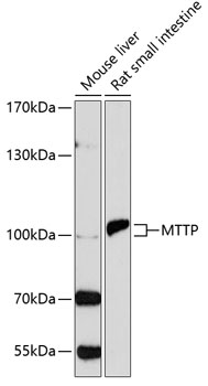 Anti-MTTP Antibody (CAB1746)