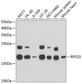 Anti-RPS10 Antibody (CAB6056)