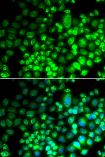 Anti-ST6GAL1 Antibody (CAB12504)