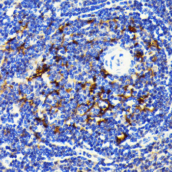 Anti-SQSTM1 / p62 Antibody [KO Validated] (CAB19700)