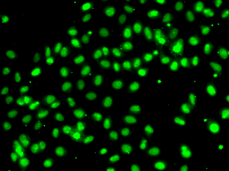 Anti-MEPCE Antibody (CAB7121)