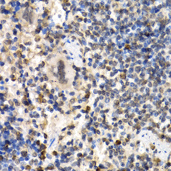 Anti-RAD1 Antibody (CAB6841)