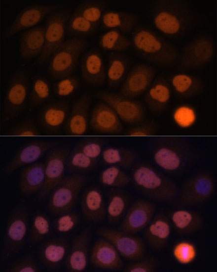 Anti-KLF6 Antibody (CAB10011)