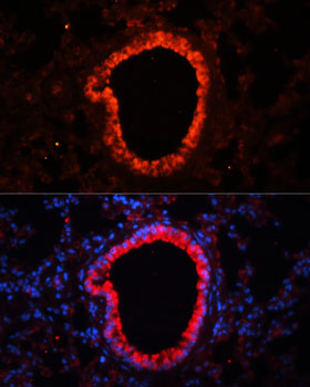 Anti-NLRC4 Antibody (CAB13117)