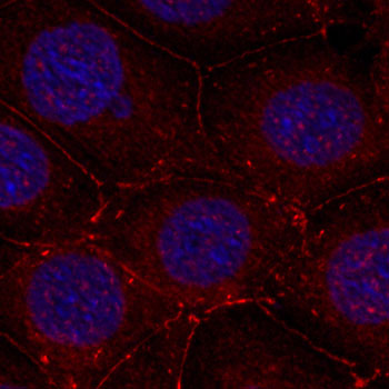 Anti-Phospho-IGF1R-Y1161 Antibody (CABP0367)