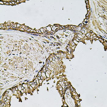 Anti-CSTB Antibody (CAB3815)