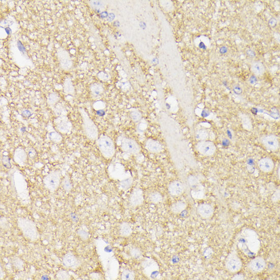 Anti-SEPT5 Antibody (CAB12953)