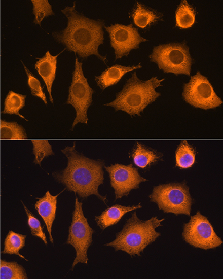 Anti-RIG-I / DDX58 Antibody (CAB13407)