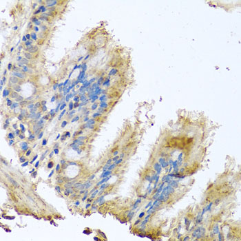 Anti-COX6B1 Antibody (CAB2641)