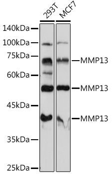 Anti-MMP13 Antibody (CAB11755)