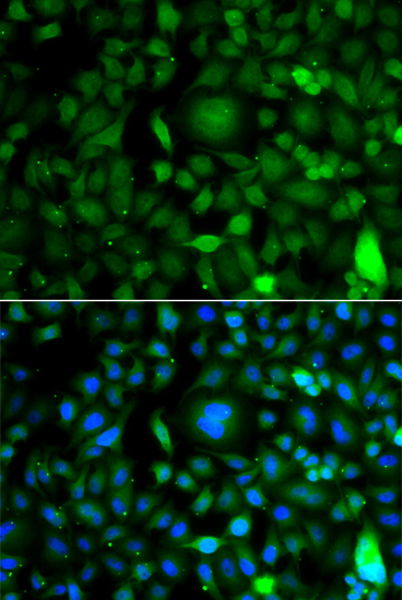 Anti-DPF1 Antibody (CAB7349)