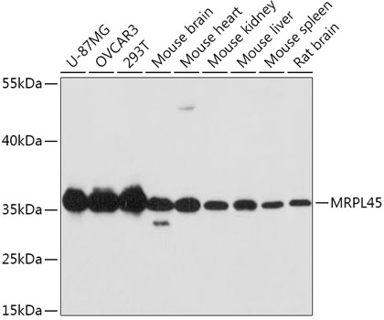 Anti-MRPL45 Antibody (CAB13197)