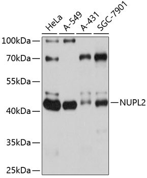 Anti-NUPL2 Antibody (CAB10779)