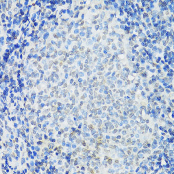 Anti-IKKEpsilon Antibody (CAB14093)