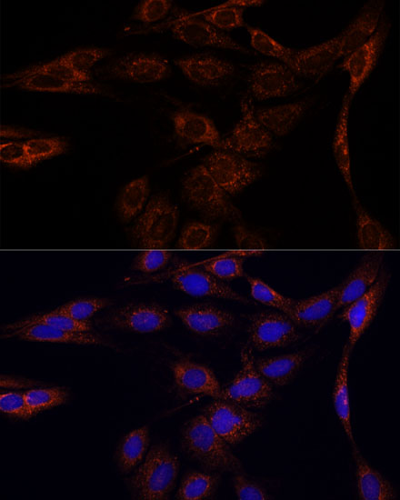 Anti-PFDN4 Antibody (CAB15300)