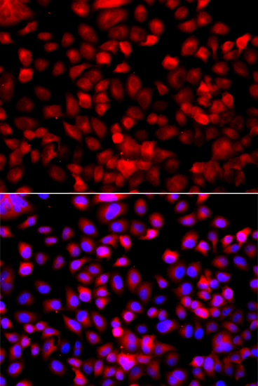 Anti-Fatty Acid Synthase Antibody [KO Validated] (CAB0462)