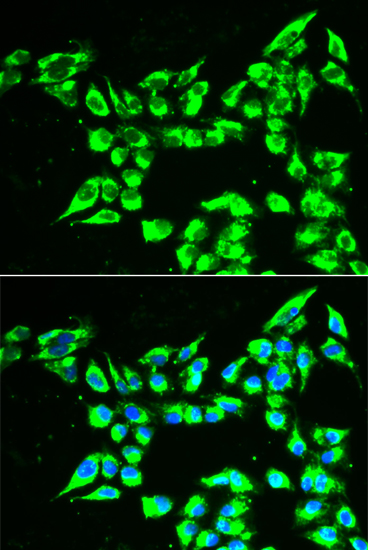 Anti-KLK10 Antibody (CAB13629)