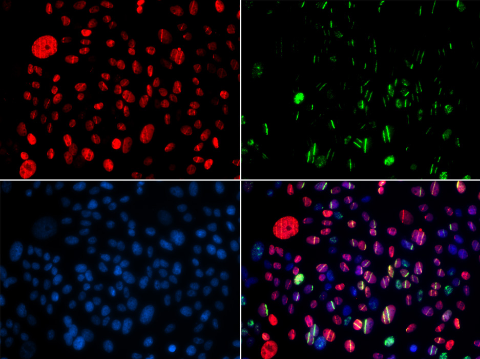 Anti-Phospho-SMC1A-S957 Antibody (CABP0090)