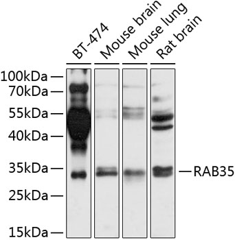 Anti-RAB35 Polyclonal Antibody (CAB8030)