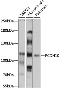 Anti-PCDH10 Antibody (CAB11632)