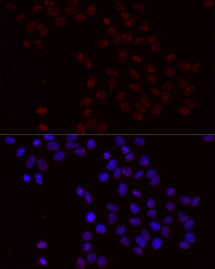 Anti-Phospho-BCL2-S70 Antibody (CABP0575)