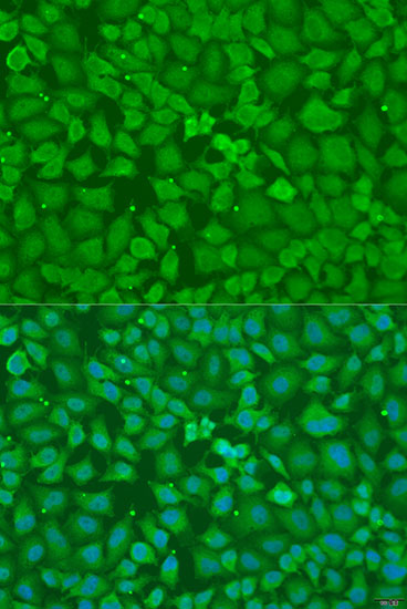 Anti-TRH Polyclonal Antibody (CAB8322)