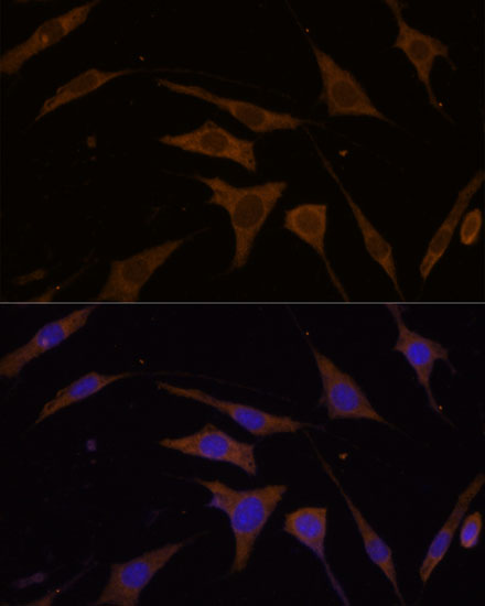 Anti-RPL7 Antibody (CAB5932)