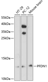 Anti-PFDN1 Polyclonal Antibody (CAB8681)