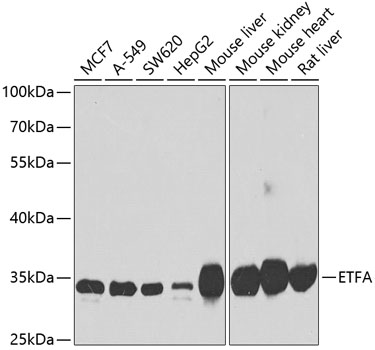 Anti-ETFA Antibody (CAB7670)