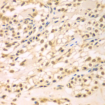 Anti-TBL1XR1 Antibody (CAB7834)