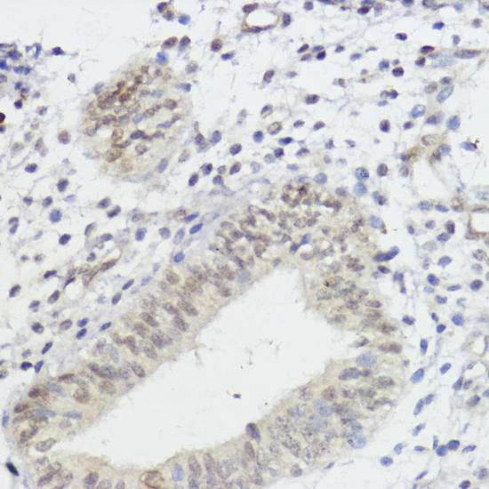 Anti-AKT1 Antibody (CAB11016)