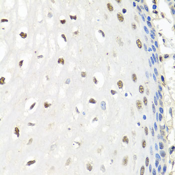 Anti-CNOT8 Polyclonal Antibody (CAB8058)