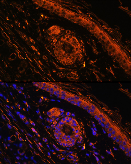 Anti-TGM1 Antibody (CAB13359)