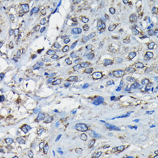 Anti-RANGAP1 Antibody (CAB13347)