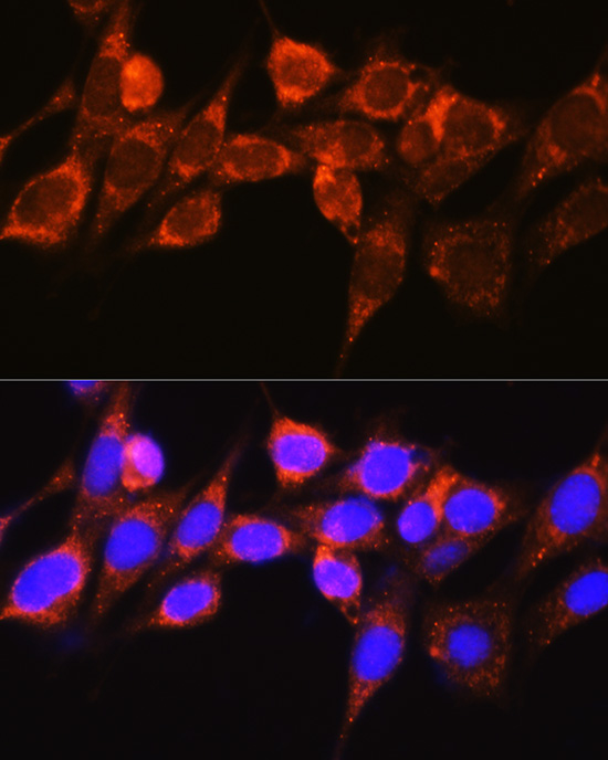 Anti-Raf1 Antibody (CAB0223)