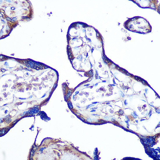 Anti-F11R Antibody (CAB1241)