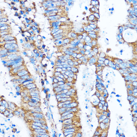 Anti-PIK3CA Antibody (CAB0265)