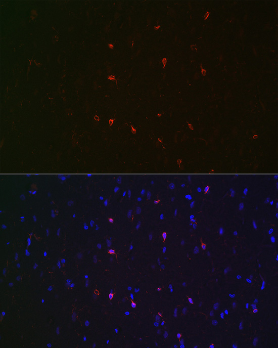 Anti-Iba1 Antibody (CAB12391)