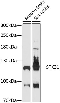 Anti-STK31 Antibody (CAB13106)