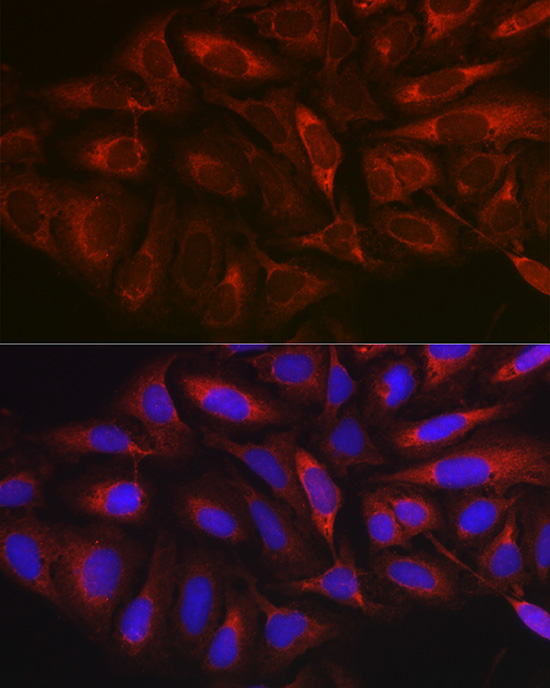 Anti-MARCKS Antibody (CAB0936)