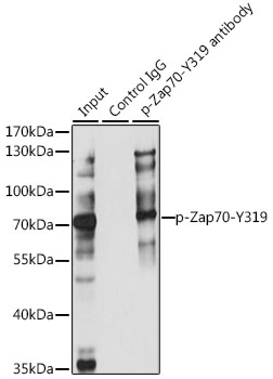 Anti-Phospho-ZAP70-Y319 Antibody (CABP0467)